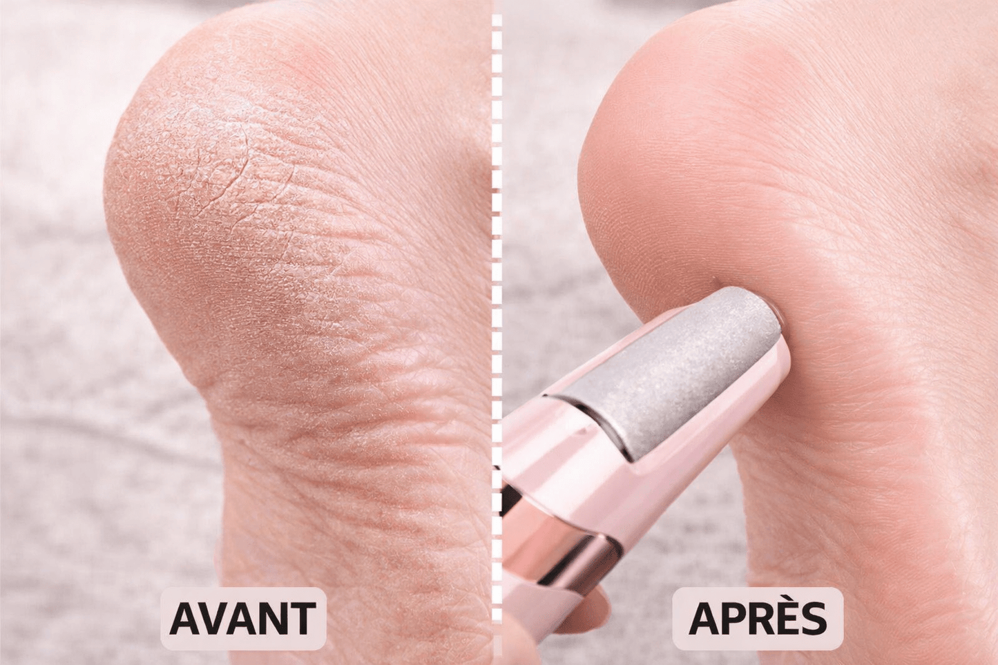 Lime Électrique professionnelle pour les pieds (une crème pieds offerte) - SamaShop