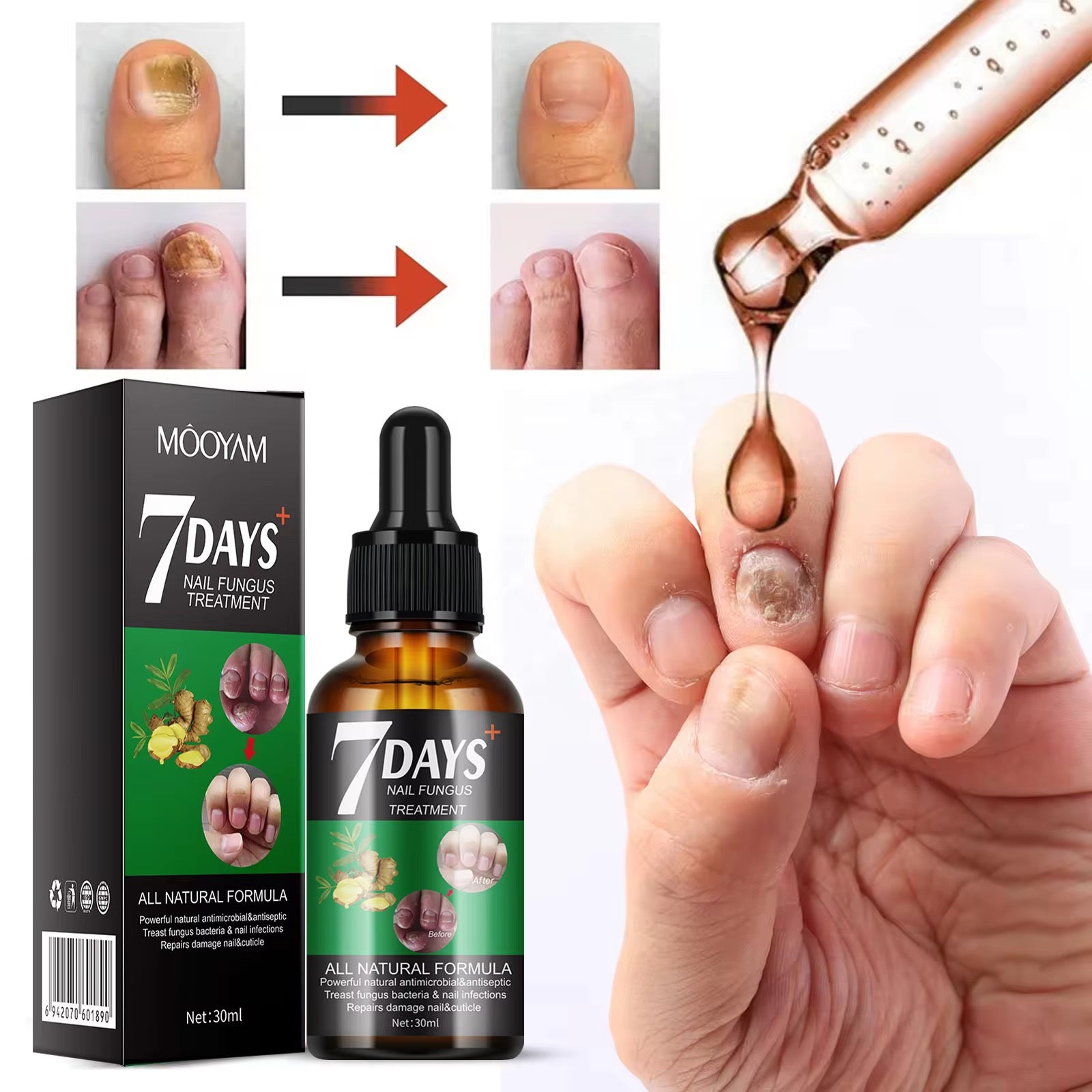 7 Days Nail Fungus Treatment – Sérum Antimycosique Ultra - Rapide pour Ongles Sains (Pour pieds et mains) - SamaShop
