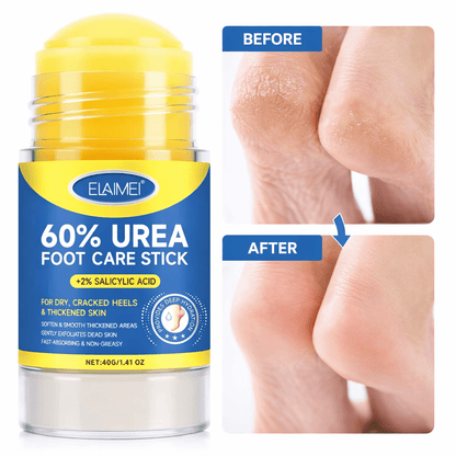 Crème pour les pieds á l'urée á absorption rapide pour soin des pieds - SamaShop