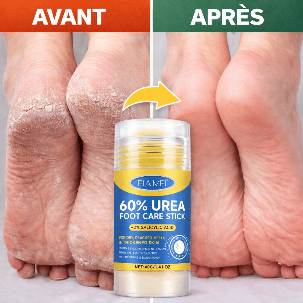 Crème pour les pieds á l'urée á absorption rapide pour soin des pieds (Ultra efficace pour pieds craquelés) - SamaShop