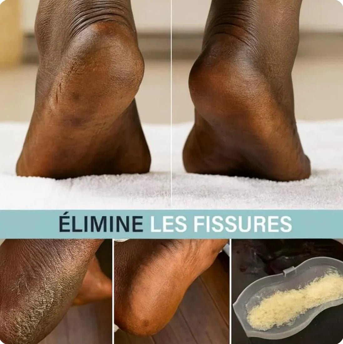 Lime Électrique professionnelle pour les pieds (une crème pieds offerte) - SamaShop