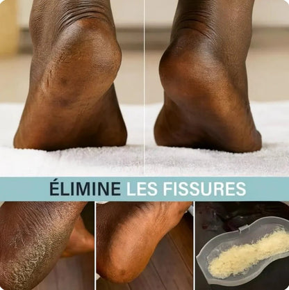 Lime Électrique professionnelle pour les pieds (une crème pieds offerte) - SamaShop