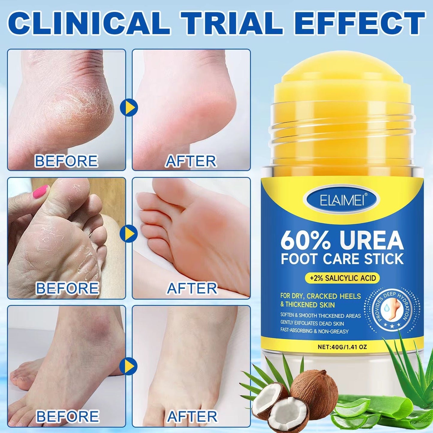 Crème pour les pieds á l'urée á absorption rapide pour soin des pieds - SamaShop